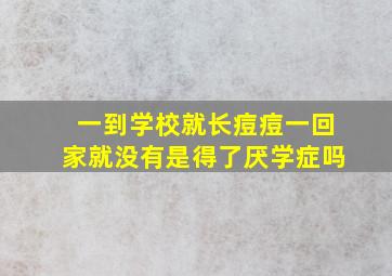 一到学校就长痘痘一回家就没有是得了厌学症吗