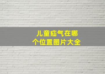 儿童疝气在哪个位置图片大全