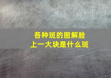 各种斑的图解脸上一大块是什么斑