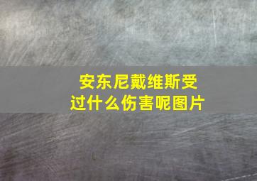 安东尼戴维斯受过什么伤害呢图片