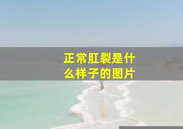 正常肛裂是什么样子的图片