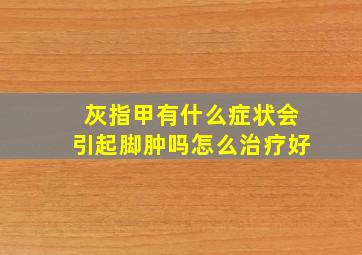 灰指甲有什么症状会引起脚肿吗怎么治疗好