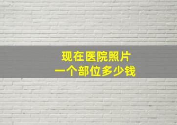 现在医院照片一个部位多少钱