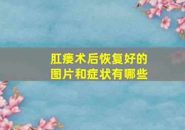 肛瘘术后恢复好的图片和症状有哪些