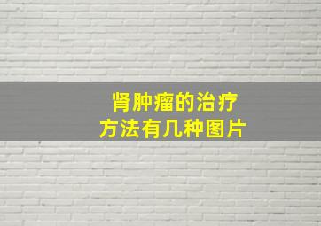 肾肿瘤的治疗方法有几种图片