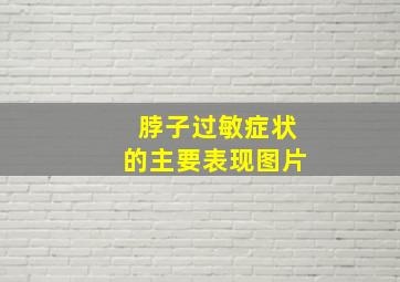 脖子过敏症状的主要表现图片