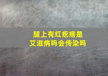 腿上有红疙瘩是艾滋病吗会传染吗