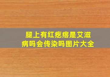 腿上有红疙瘩是艾滋病吗会传染吗图片大全