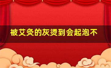 被艾灸的灰烫到会起泡不