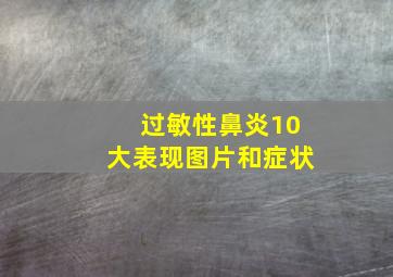 过敏性鼻炎10大表现图片和症状