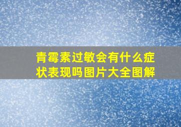 青霉素过敏会有什么症状表现吗图片大全图解